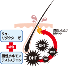 AGAのメカニズム