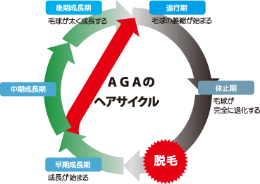 ヘアサイクルの乱れ