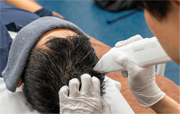 MINOXI JET（ミノキジェット）